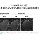 シタグリプチンの脂肪肝改善